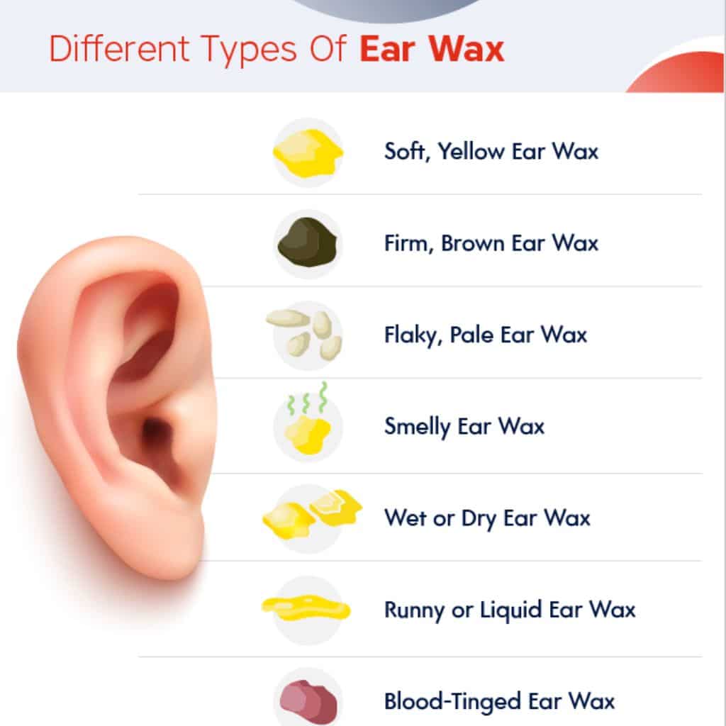 infected ear wax