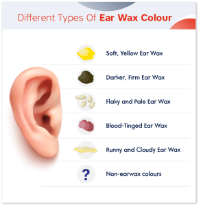 Ear Wax Colour – What the Colour of Your Ear Wax Indicates